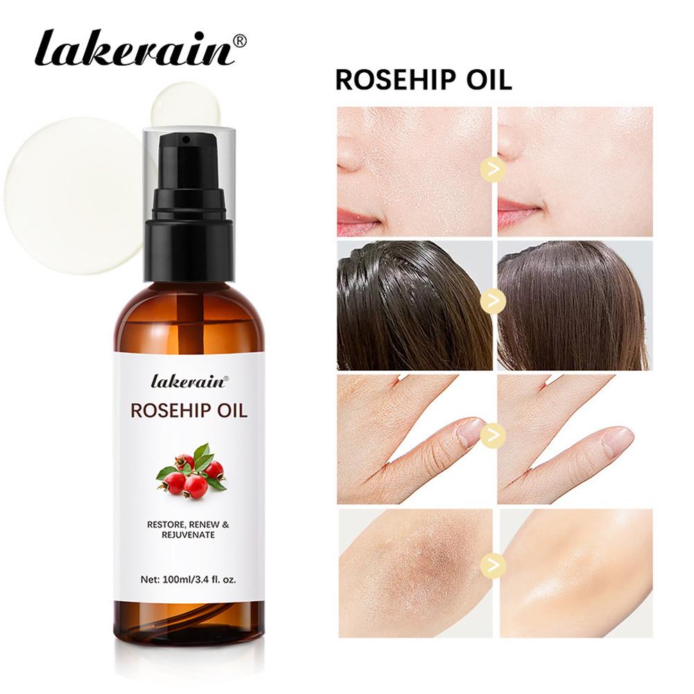 Rosehip Oil For Face & Skin Or – обзор и цена Cold Pressed Rose Hip