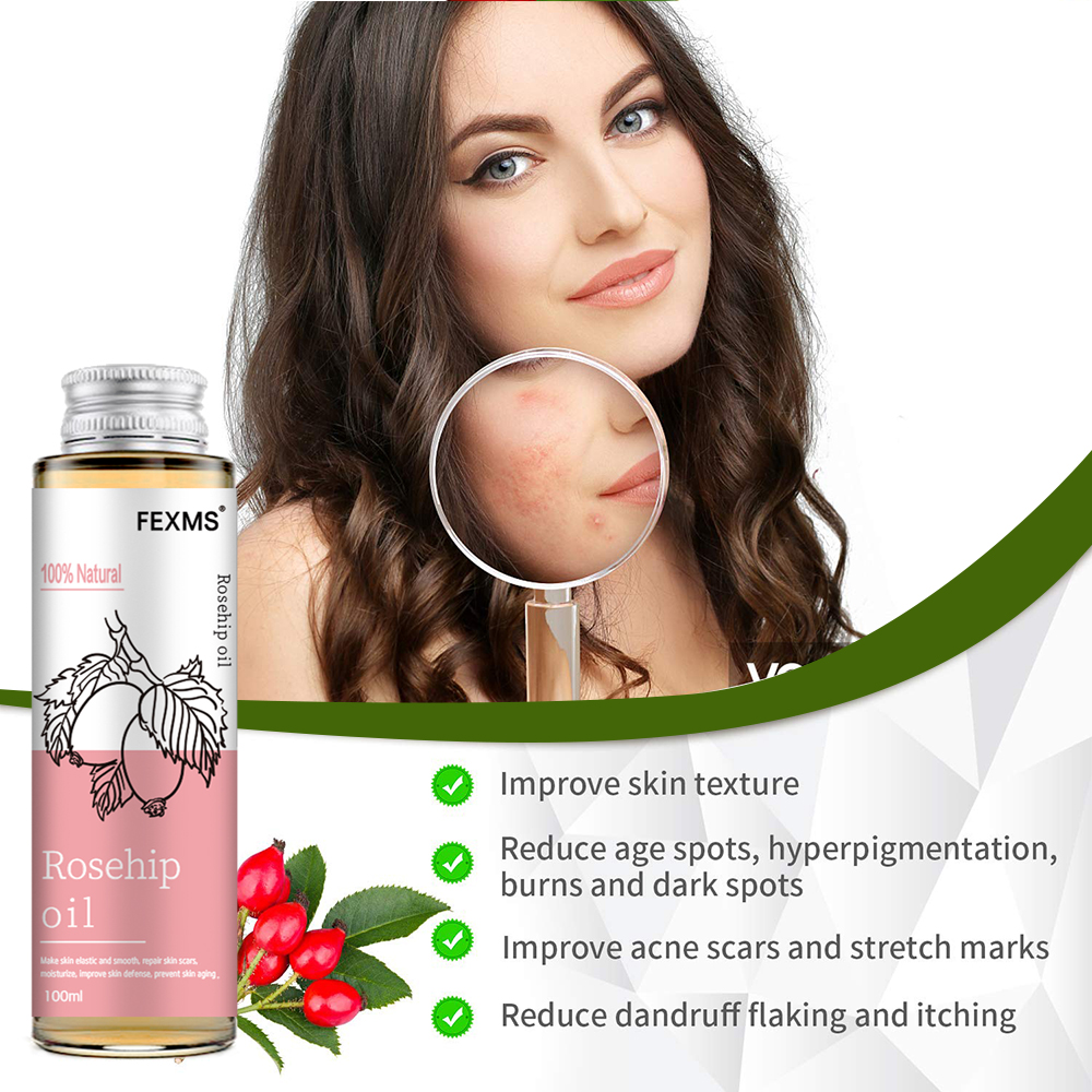 Rosehip Seed Oil, 100% Pure Or – обзор и цена Cold Pressed Rose Hip