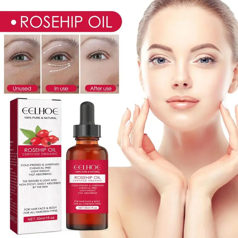 30ml Organic Rosehip Seed Oil  – обзор и цена Cold Pressed Rose Hip